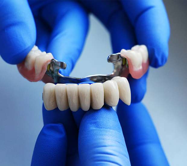 Issaquah Dental Bridges